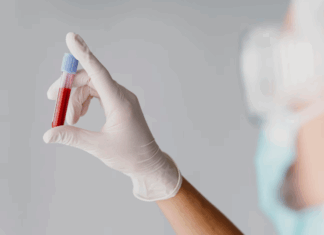 Густая кровь: причины, последствия и профилактика