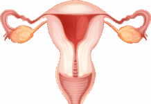 Лечение эндометриоза в санатории: комплексный подход к боли и восстановлению